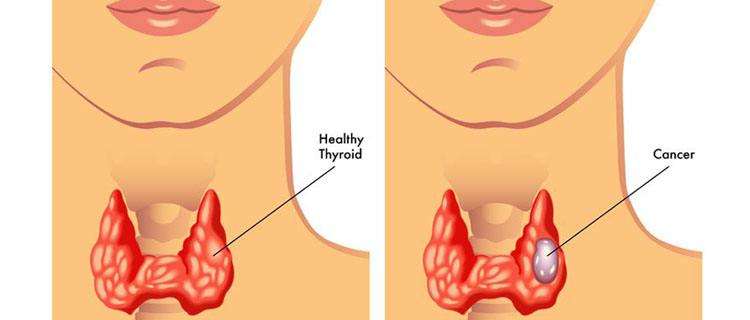 221540190842174431.jpg timg (1).jpg