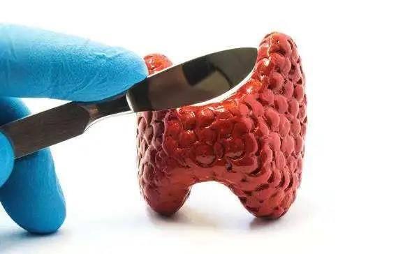 151608016571713233.jpeg 9380e1eea2bc0056ed83389aa06a4750_a686c9177f3e670977a696f85a11273af9dc5575_token=f7505224399cb268933a0a1cd113e945&s=B812549658F142940B844AF5030080A2.jpeg